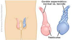 Torsión testicular